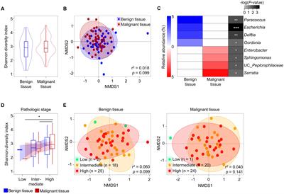 Influence of diabetes on microbiome in prostate tissues of patients with prostate cancer